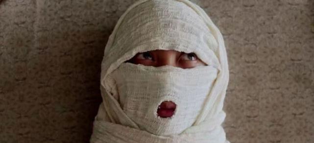 就是剧中他被范闲打成重伤,全身裹满白布,只露出两只眼睛