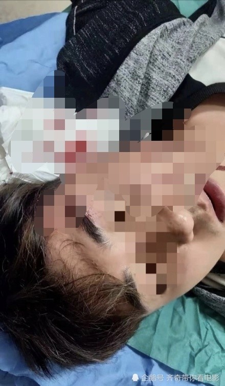 沈阳研究生被捅伤三个月,警方回应:正在抓人!