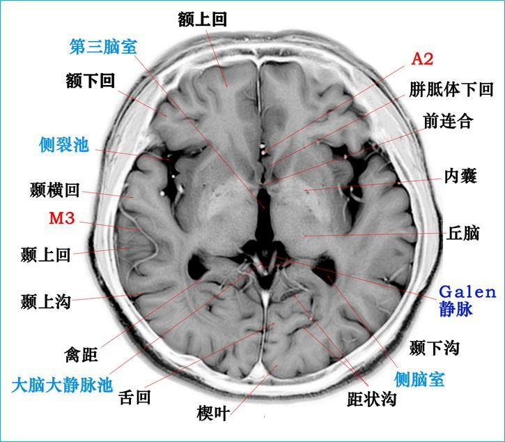 史上最全断层解剖图谱!建议收藏!