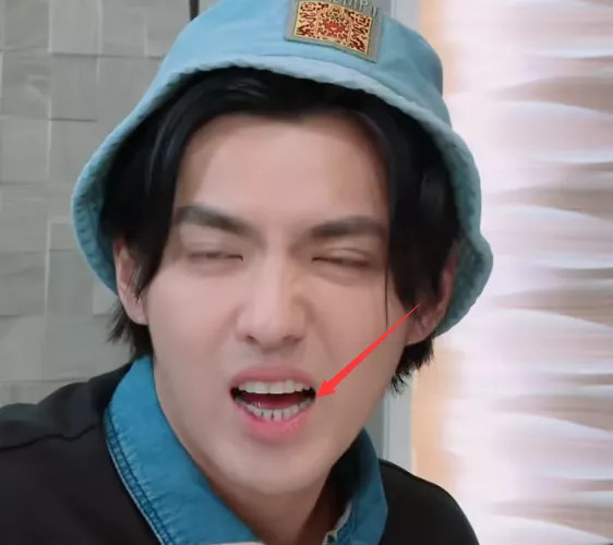 有一种牙缝叫吴亦凡的牙缝,看着很黑,却是大家都想要的