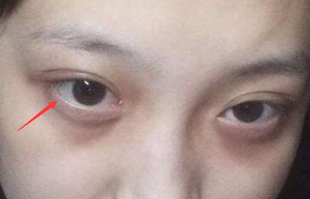 女孩这3地方"发黑",当心子宫"闹脾气",但愿你一个不占!