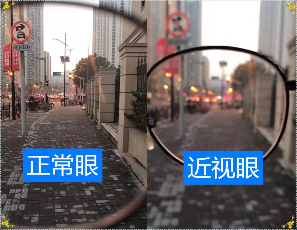 有种"世界之窗"叫"眼睛",正常眼vs近视眼,网友:怪不得打招呼不理我
