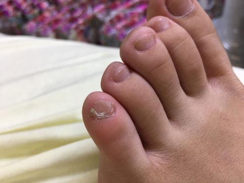 小脚趾甲分成两瓣的,才是纯正的汉族人?有什么科学依据吗