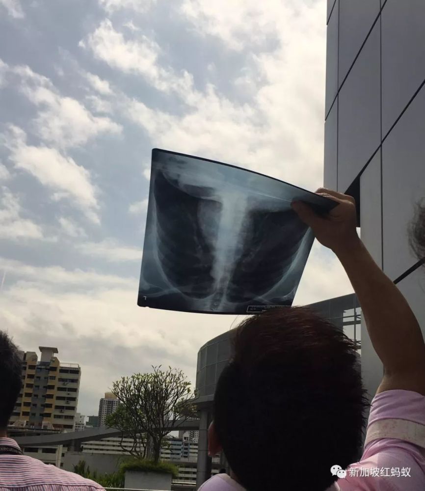 中国看不到的日环食 新加坡人居然拿出X光胸片