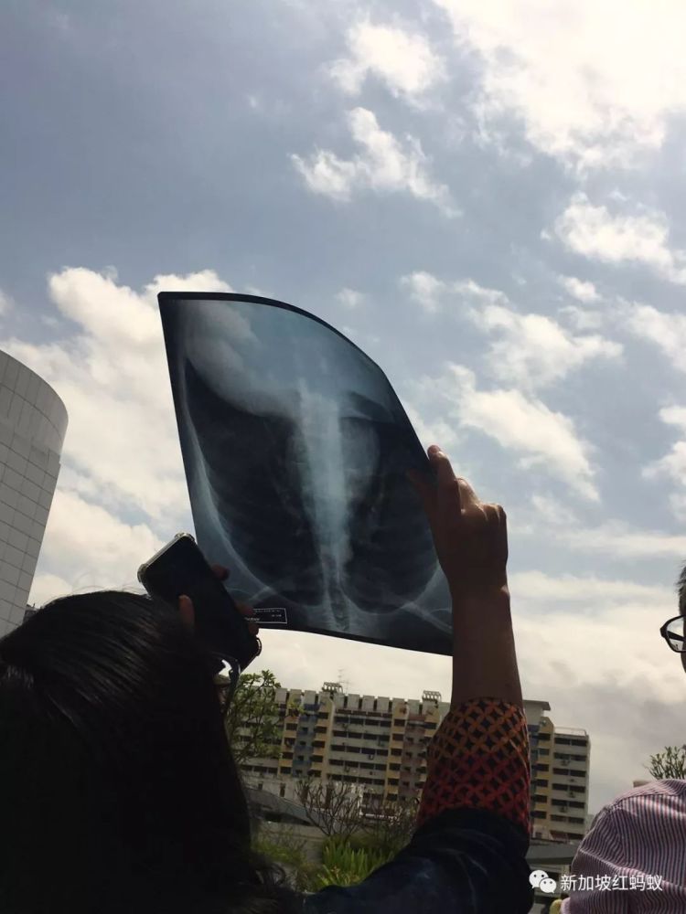 中国看不到的日环食 新加坡人居然拿出X光胸片
