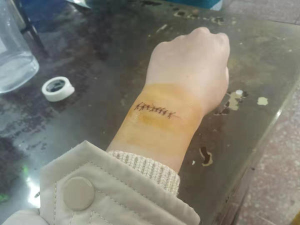 安阳一女生自残 家属:老师说话太难听 校长:百分