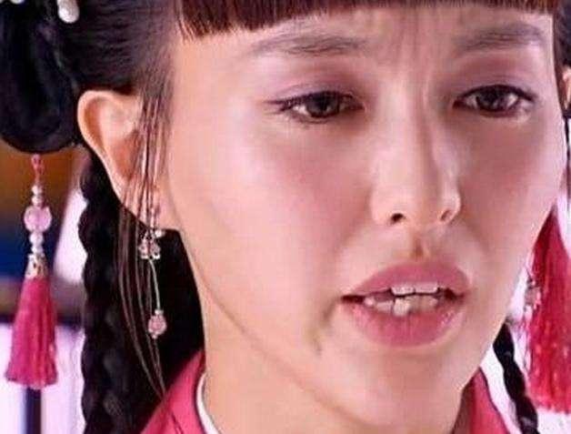 牙齿怎么样才算龅牙 什么样的牙齿才算龅牙