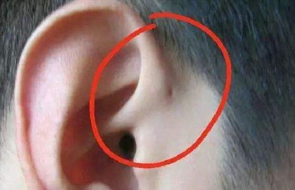 可是总有一些人闲着没事,看见宝宝耳朵上面有个小洞,就想着用手挤一挤