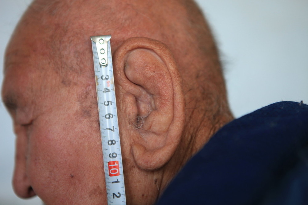 谁说长寿没征兆专家说耳朵上有这2个特征的人很容易长寿