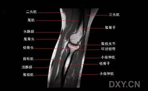 它位於腕關節的尺側,包括腕關節尺側伸肌腱鞘,橈尺背側韌帶,三角纖維