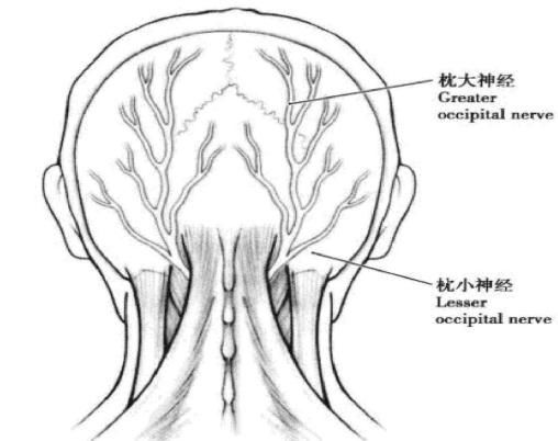 龙氏正骨 枕神经痛 腾讯新闻