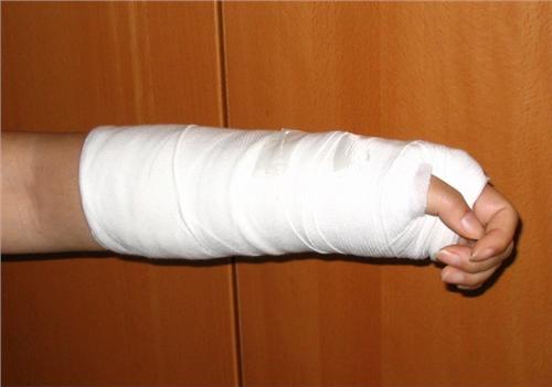 容易骨折就是缺钙了这6种人别急着补钙会加速骨头脆化