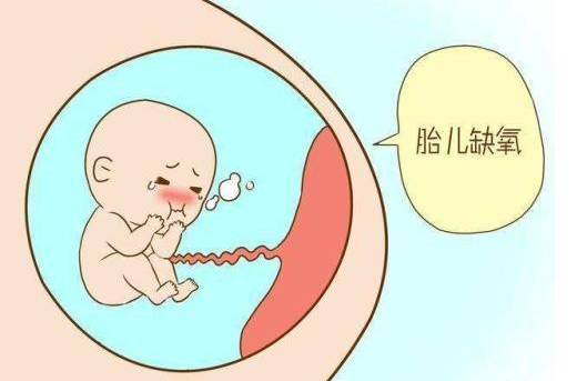 胎儿出现宫内缺氧,可能会引起胎儿生长受限,永久性的脑损伤,甚至胎死