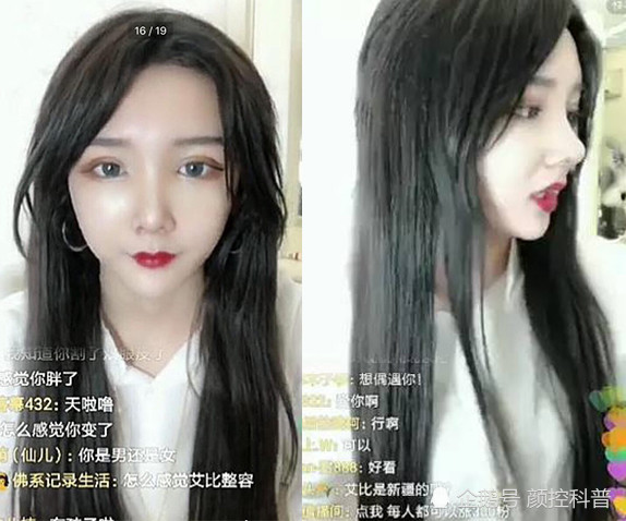 直播女神 变成 纯爷们 科普 网红流水线整容的致命弊端 腾讯新闻