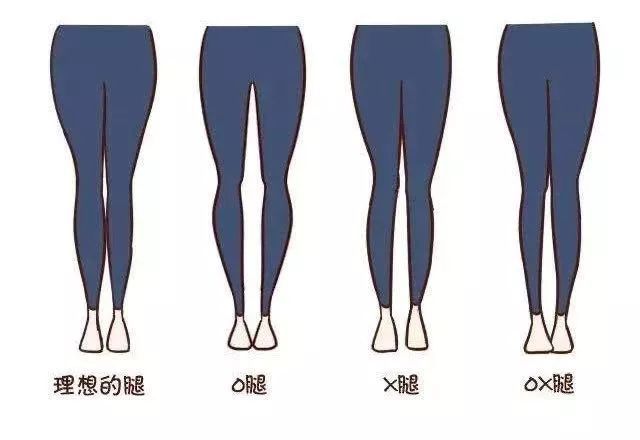 ox腿型图片对照表图片