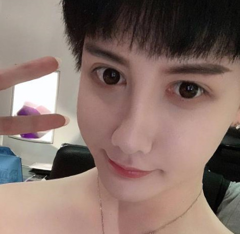 "蛇精脸"刘梓晨近照,下巴变圆,脸型恢复正常,网友:你终于醒悟了!