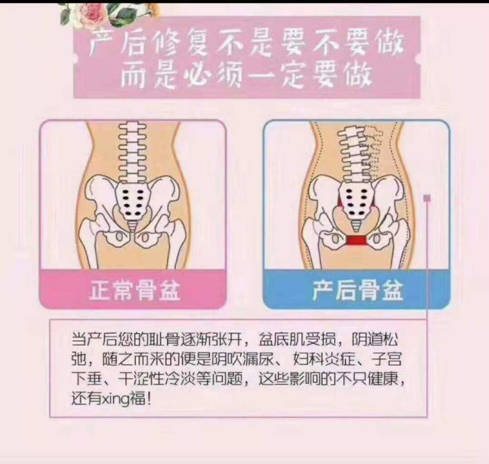 产后骨盆问题越来越多,一定是这三个方面出了大问题,一定要改_腾讯新
