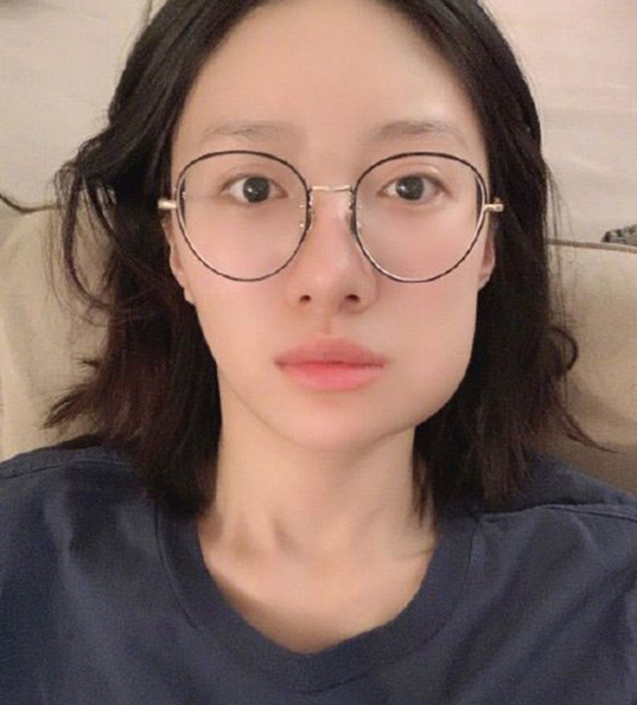 周冬雨拔完智齿脸肿如馒头评论区晒图太精彩堪称大型比丑现场