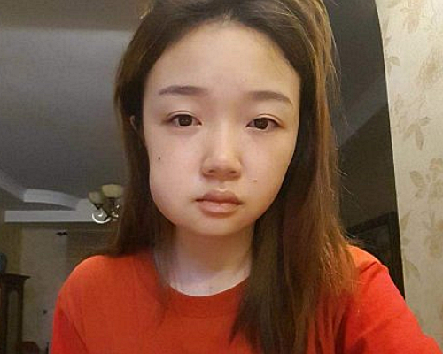 周冬雨拔完智齿脸肿得像馒头,评论区晒图成亮点,像