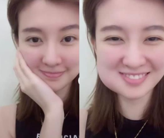 周冬雨拔完智齿脸肿如包子,深夜晒照求助却被网友恶搞p图,心疼又好笑