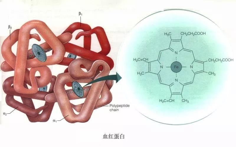 地中海贫血患者由于珠蛋白基因缺陷而导致血红蛋白中一种或者多种珠