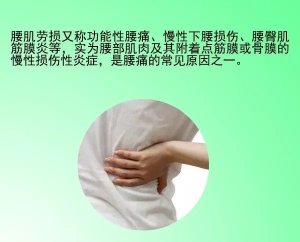 腰部酸痛或胀痛是腰肌劳损吗