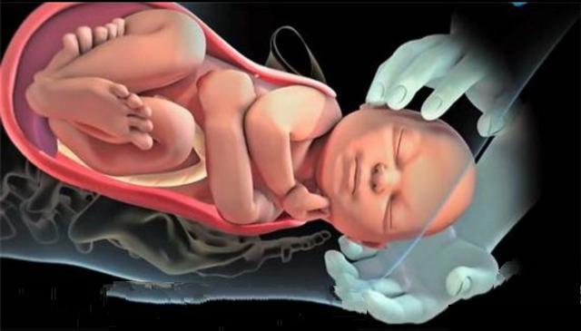 顺产也就是自然分娩,就是胎儿从母体产道娩出的过程.