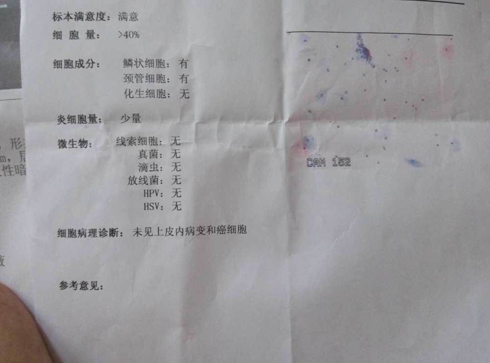 女人去检查TCT,显示LSIL是什么意思?这