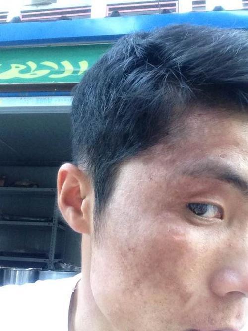 3种食物堪称"祛斑高手",每天换着吃,排出黑色素,远离黄褐斑