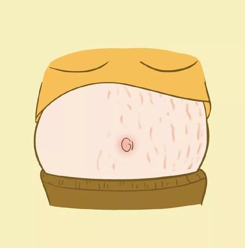 这些恼人的纹路悄悄爬上你的身体膨胀纹到底是什么