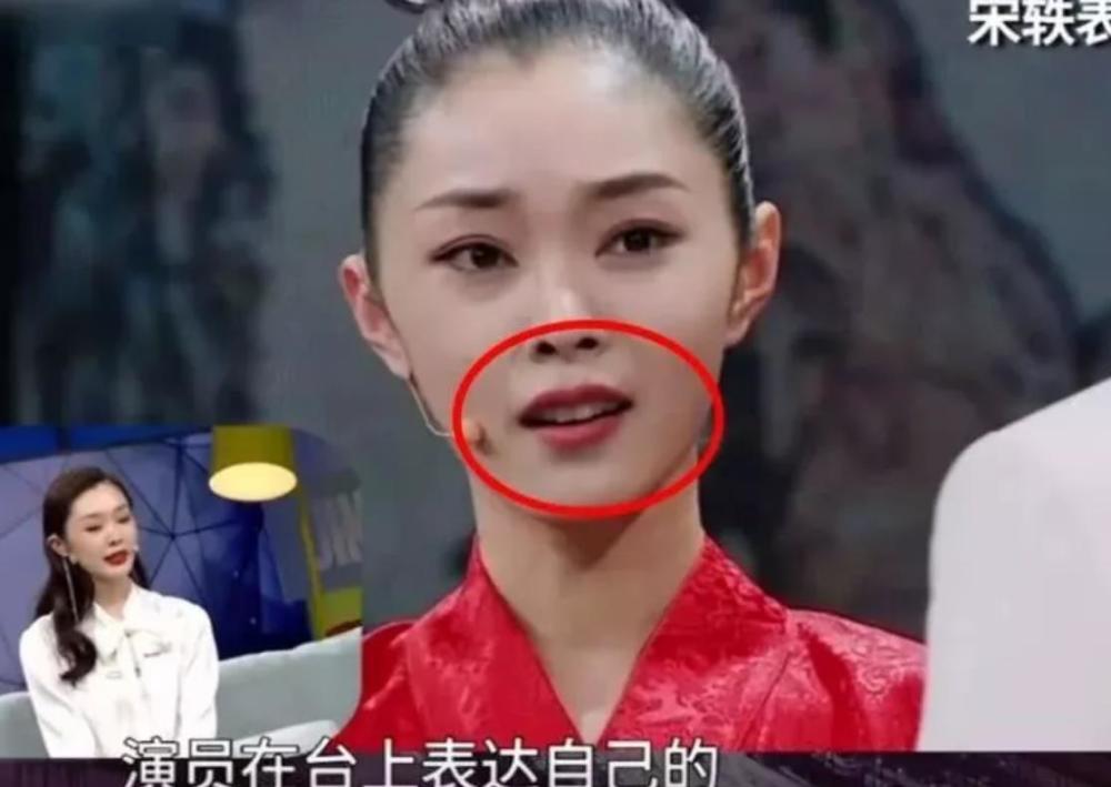 宋轶自曝演《庆余年》被叫龅牙珍,就连亲妈也吐槽牙丑,如今整牙后判若