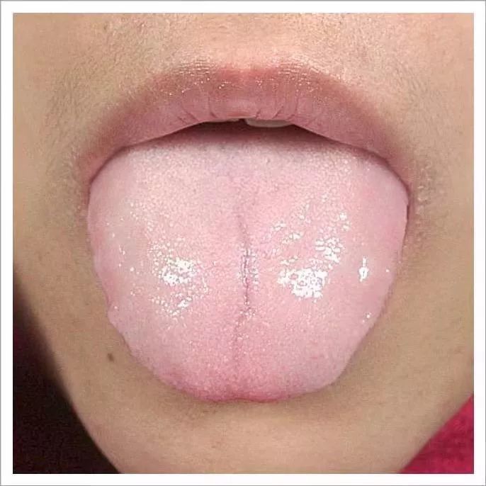 天气越来越冷阳虚和气虚之人该如何过冬