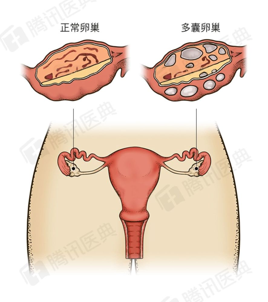 女生长得胖竟然会吓走大姨妈现在不减肥以后怀不上孩子可别哭