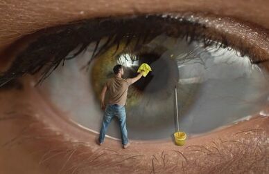 甚至连治疗青光眼的毛果芸香碱及毒扁豆碱滴眼液,也可促使晶状体混浊