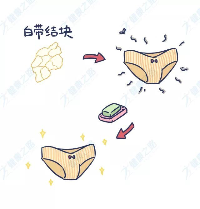 身体好不好,白带会"说话!出现6种异常,赶紧看医生!