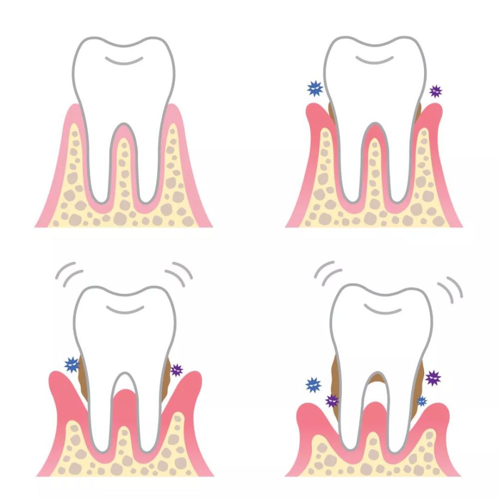 人为什么会牙疼?
