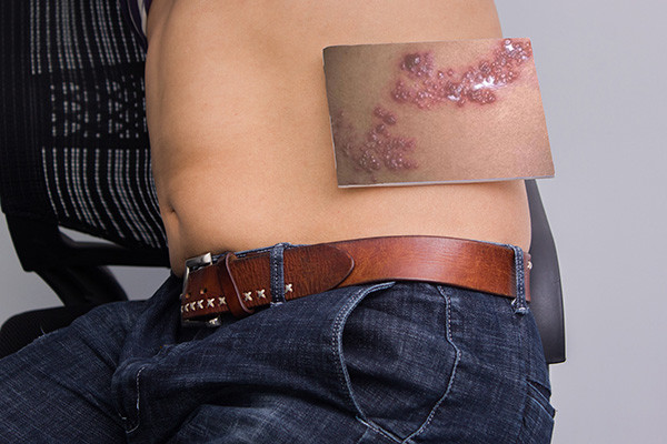 民间传言"缠腰火龙"缠满一圈,就会要人命,是迷信还是真相?