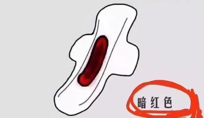 姨妈颜色 腾讯网