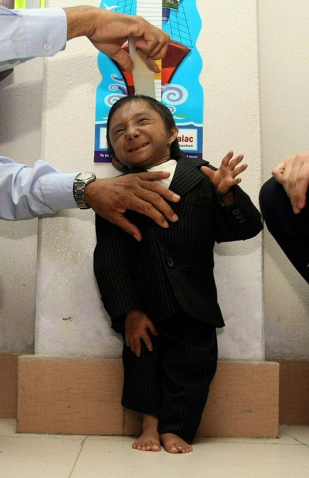 08厘米,终年27岁,世界上最矮的人尼泊尔去世