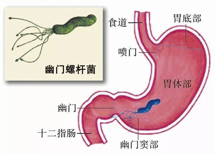 胃窦在哪里位置图片图片