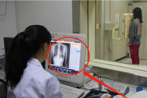 为何女生都害怕做"胸透"?医生通过机器能看见什么?看完才知道