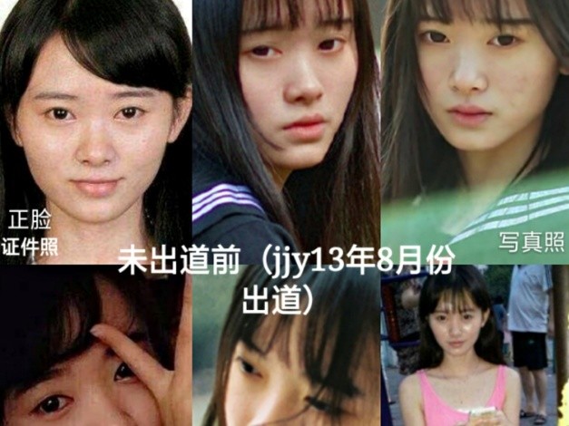 被整容医院认领鞠婧祎的确不是纯天然她现在的颜值太惊艳