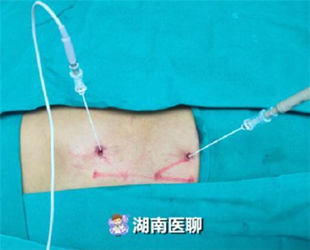 高三学生手掌多汗沾湿试卷专家两针五分钟解决问题