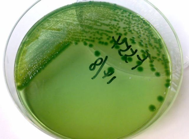 弧菌是一种条件致病菌,在正常的养殖池塘中也是有弧菌存在的,也就是说