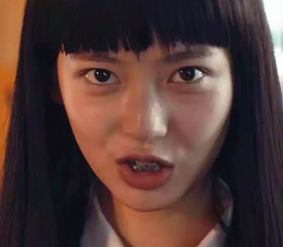 摘掉牙套后,美到认不出