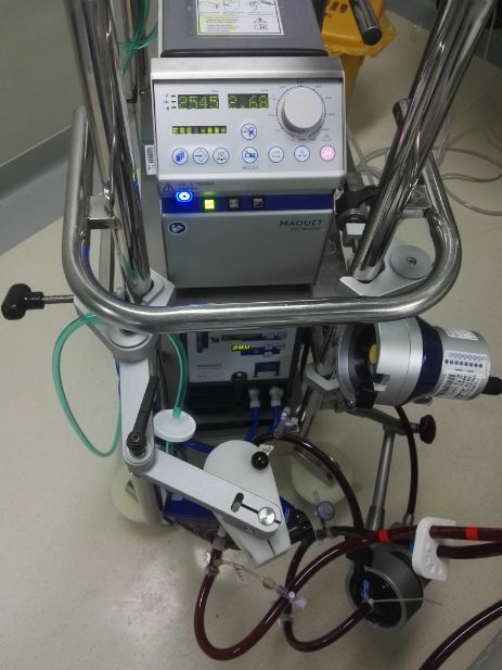 ecmo何方神圣?怎么成功救治了一名新型冠状病毒患者