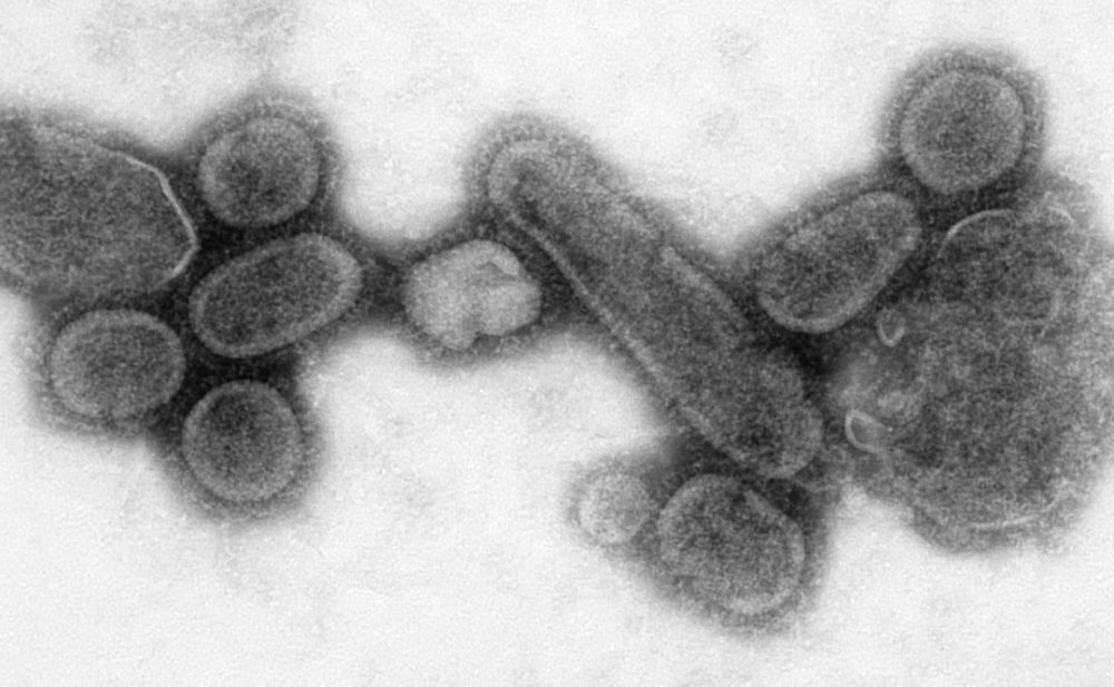 重建的西班牙流感病毒(图/网络)从黑死病到西班牙大流感,我们可以
