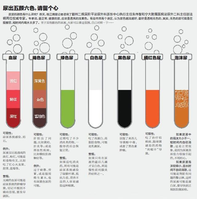 医生尿出这3种颜色的尿液需要来医院找我