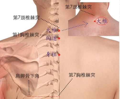 对付口腔溃疡,中医有妙法|中医|经络腧穴学|上火|口腔溃疡