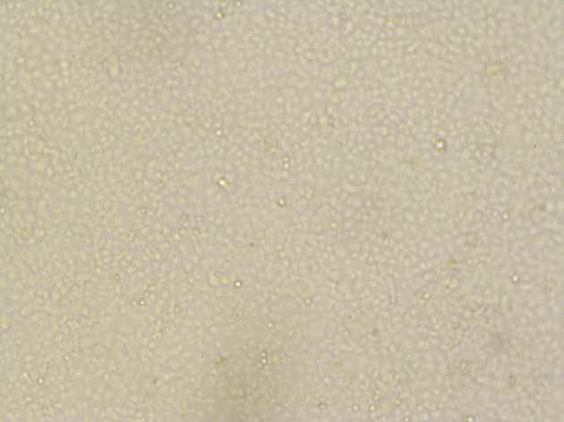 正常的vero-E6传代细胞